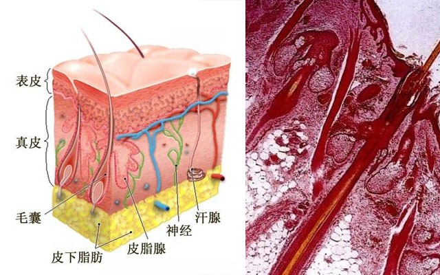 为什么有的人总长痘？这5个原因你中了几个？