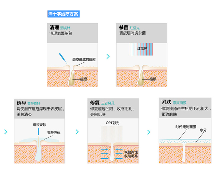 祛痘方法